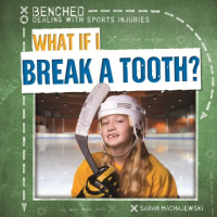 What_if_I_break_a_tooth_